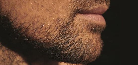 aplicar o oleo para a barba