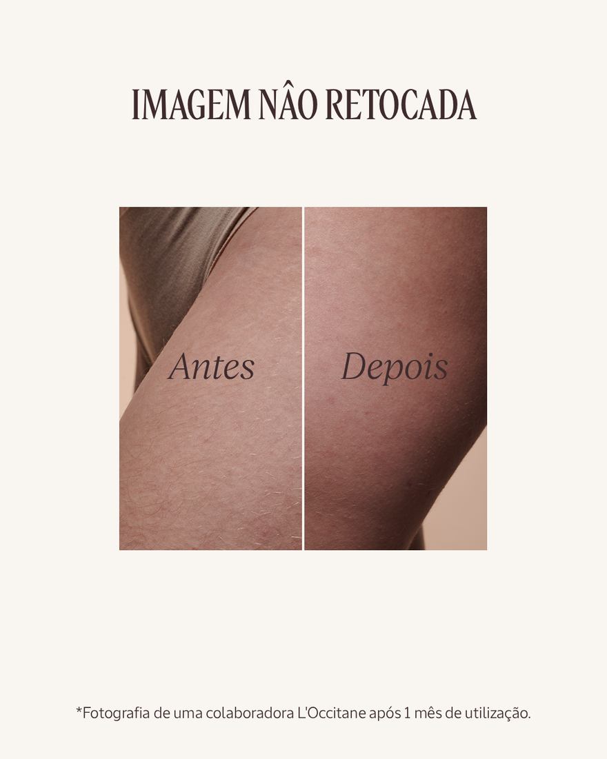 Ver a imagem 3/9 do produto Recarga &Oacute;leo de Corpo Anti Estrias Am&ecirc;ndoa, , RECT