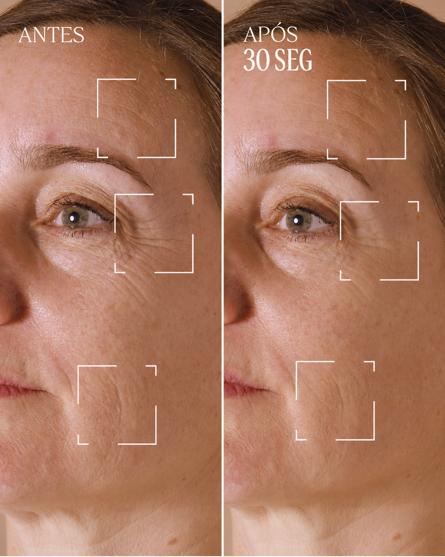 Ver a imagem 9/10 do produto Tratamento para Rugas Localizadas Immortelle Divino, , RECT